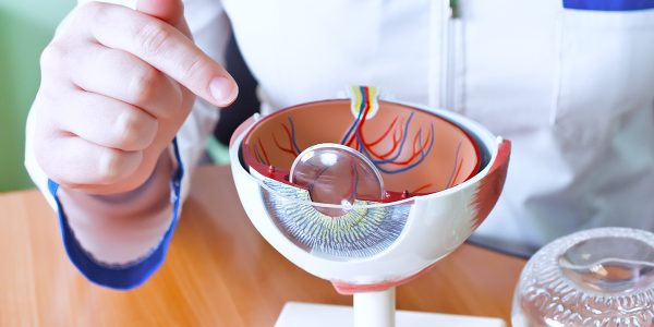 early cataract surgery