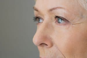 Intacts for Keratoconus in the Bay Area