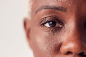 Close-up shot of a woman's eye post-LASIK surgery