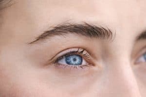 Close-up shot of a woman's eye during PRK recovery in San Jose